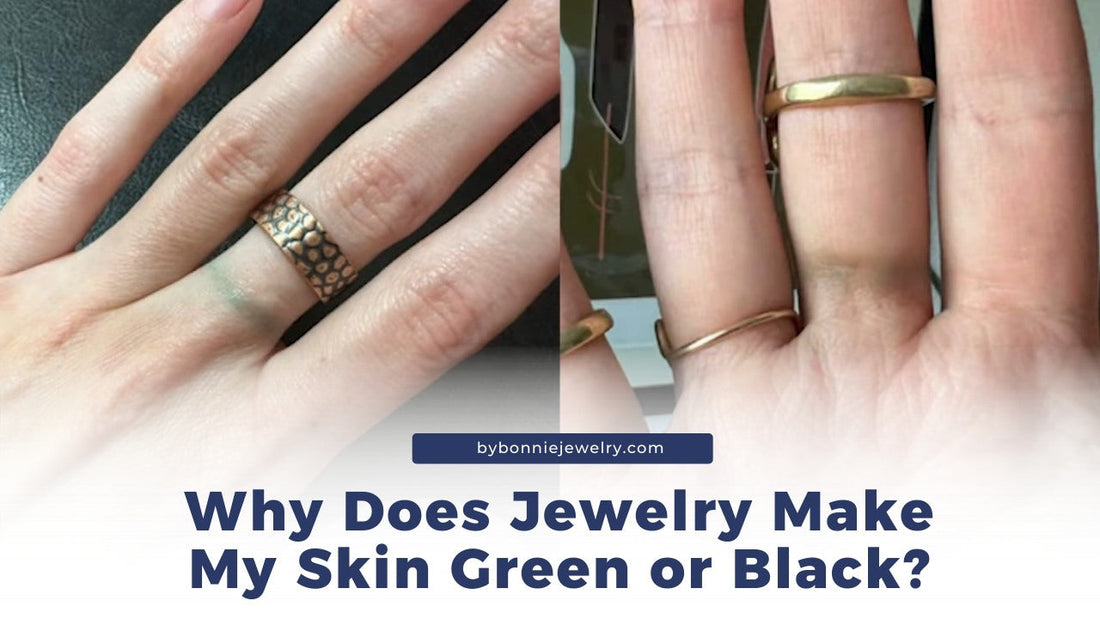  Why is my skin turning green/black when I wear jewelry?